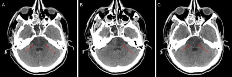https://cdn.ncbi.nlm.nih.gov/pmc/blobs/ba43/12036365/f94f81e45558/CASE24870_figure_3.jpg