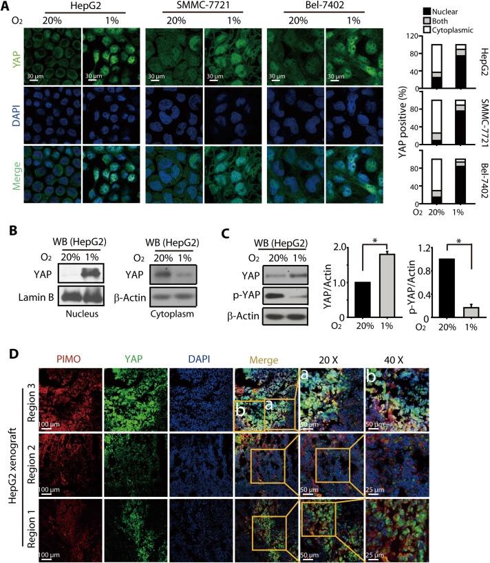 https://cdn.ncbi.nlm.nih.gov/pmc/blobs/ba46/4872759/f3f5f3b76276/oncotarget-07-6933-g002.jpg