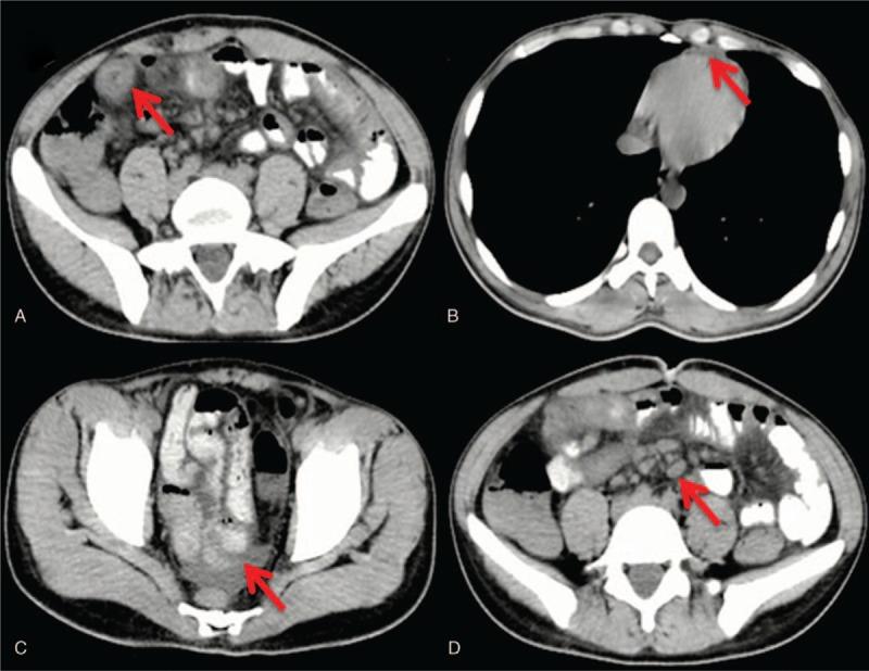 https://cdn.ncbi.nlm.nih.gov/pmc/blobs/ba48/6946351/88fd31e2ec53/medi-99-e18602-g001.jpg