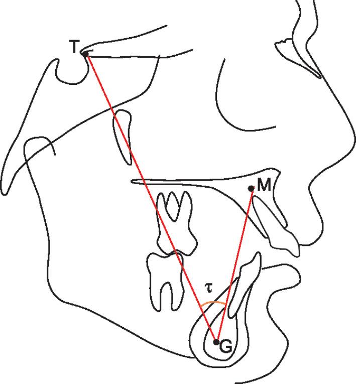 https://cdn.ncbi.nlm.nih.gov/pmc/blobs/ba52/7887183/6fbfe32e78ce/ijcpd-13-497-g001.jpg