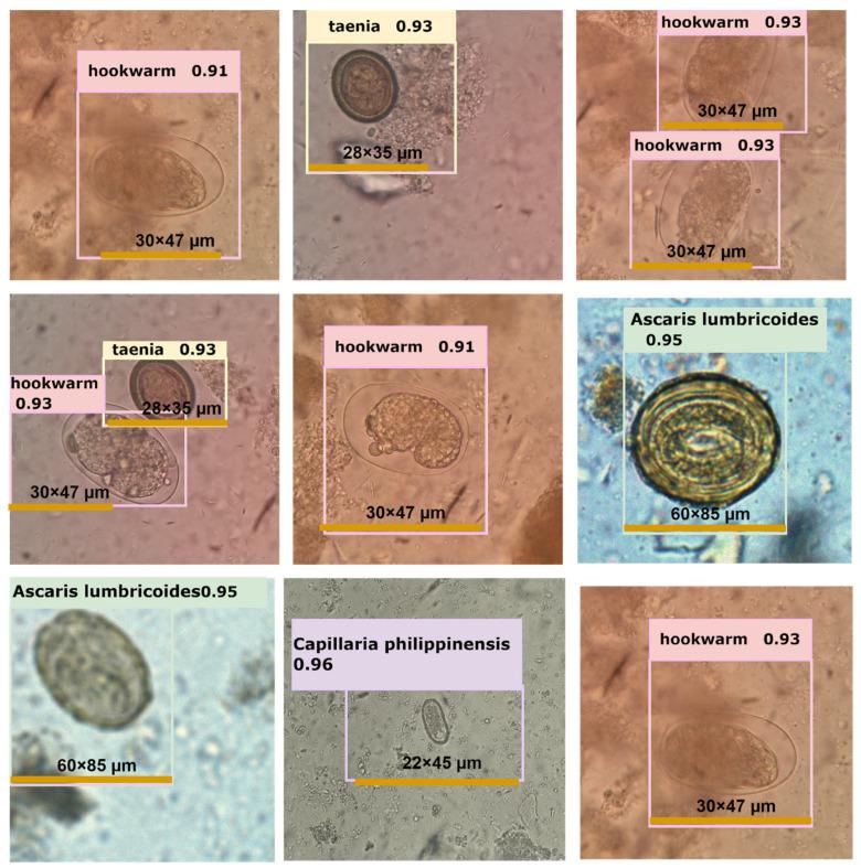 https://cdn.ncbi.nlm.nih.gov/pmc/blobs/ba57/10527934/80bec13d8773/diagnostics-13-02978-g006.jpg