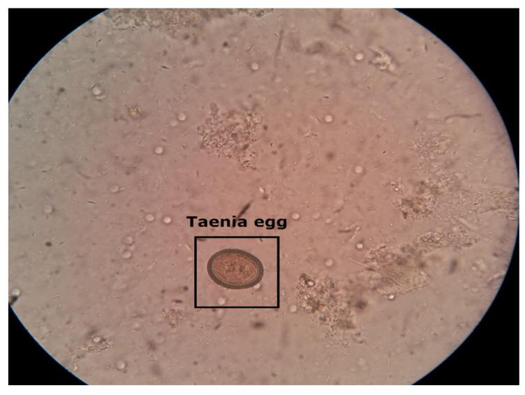 https://cdn.ncbi.nlm.nih.gov/pmc/blobs/ba57/10527934/b3941244c735/diagnostics-13-02978-g002.jpg