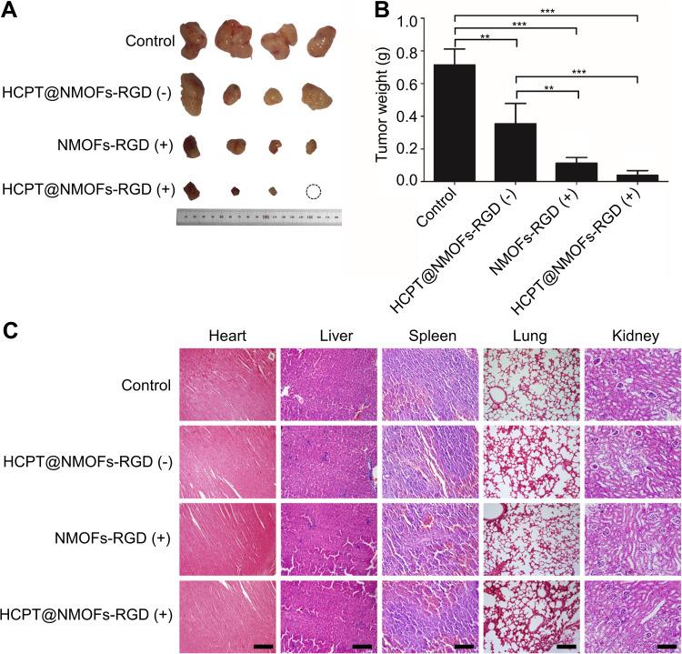 https://cdn.ncbi.nlm.nih.gov/pmc/blobs/ba58/8964448/c04f19d6bc33/IJN-17-1381-g0008.jpg
