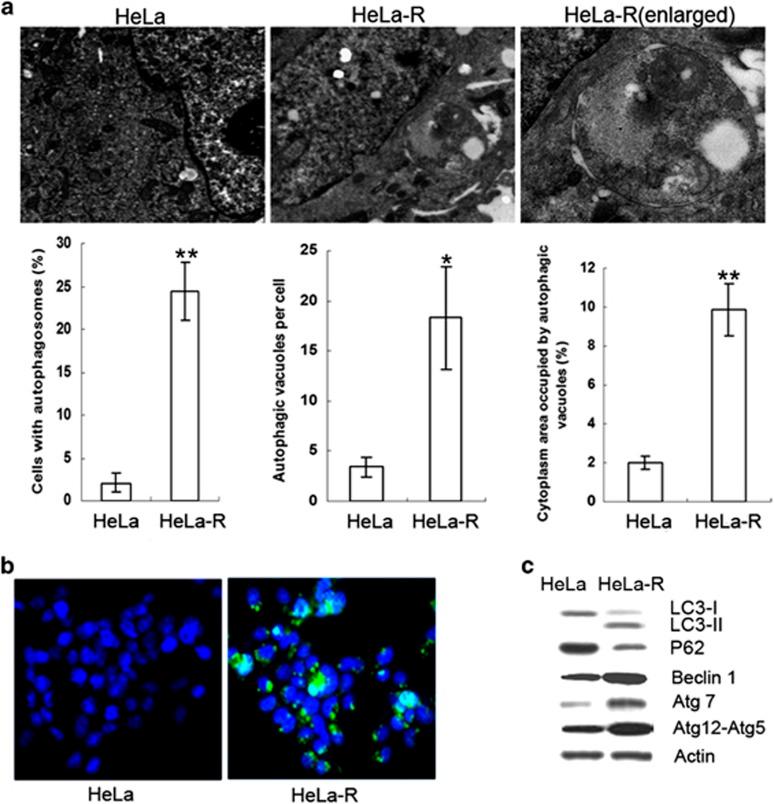 https://cdn.ncbi.nlm.nih.gov/pmc/blobs/ba62/4454295/e401d60136a8/cddis2014297f2.jpg