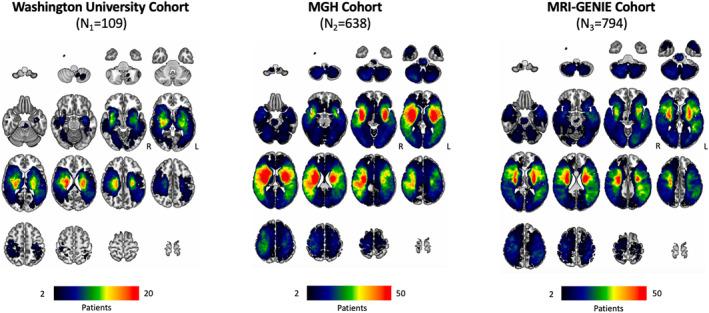 https://cdn.ncbi.nlm.nih.gov/pmc/blobs/ba7a/11651206/4cc052f6c0c5/ACN3-11-3081-g003.jpg