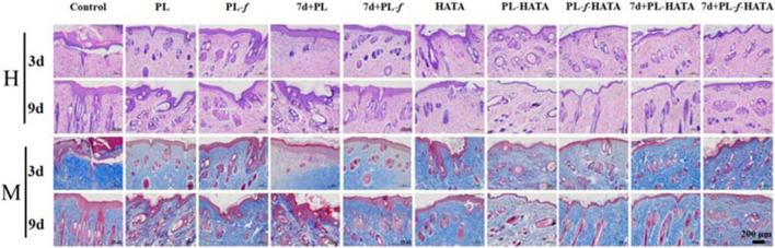 https://cdn.ncbi.nlm.nih.gov/pmc/blobs/ba81/11841398/47d44b4a8239/fphar-16-1504120-g008.jpg