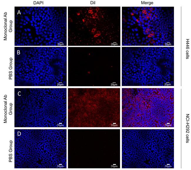 https://cdn.ncbi.nlm.nih.gov/pmc/blobs/ba85/5652846/f8c2c2933864/oncotarget-08-78153-g003.jpg