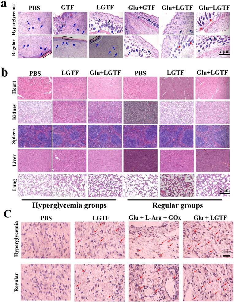 https://cdn.ncbi.nlm.nih.gov/pmc/blobs/ba87/11177078/6814762b41e6/gr6.jpg