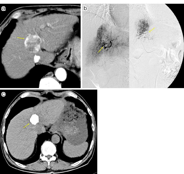 https://cdn.ncbi.nlm.nih.gov/pmc/blobs/ba88/12078018/0c963d19504f/2432-0935-10-e2024-0016-g003.jpg