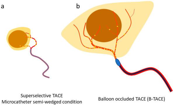 https://cdn.ncbi.nlm.nih.gov/pmc/blobs/ba88/12078018/b69cb0ffab09/2432-0935-10-e2024-0016-g010.jpg