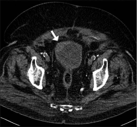 https://cdn.ncbi.nlm.nih.gov/pmc/blobs/ba8a/4127865/595dd9a4e20b/UA-6-247-g002.jpg