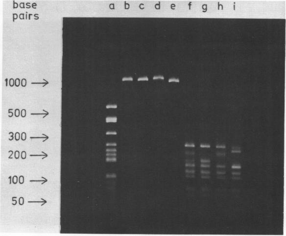 https://cdn.ncbi.nlm.nih.gov/pmc/blobs/ba91/326669/8a09287728cb/nar00394-0082-a.jpg