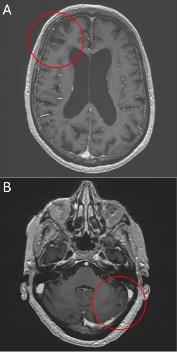 https://cdn.ncbi.nlm.nih.gov/pmc/blobs/baa5/12021617/092f60c96b10/fonc-15-1555897-g004.jpg