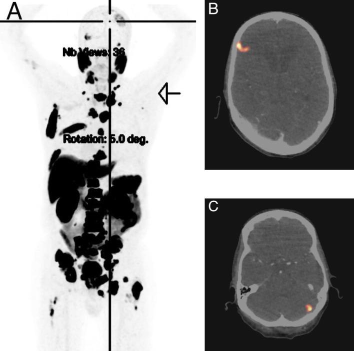 https://cdn.ncbi.nlm.nih.gov/pmc/blobs/baa5/12021617/fb9d53b6833a/fonc-15-1555897-g002.jpg