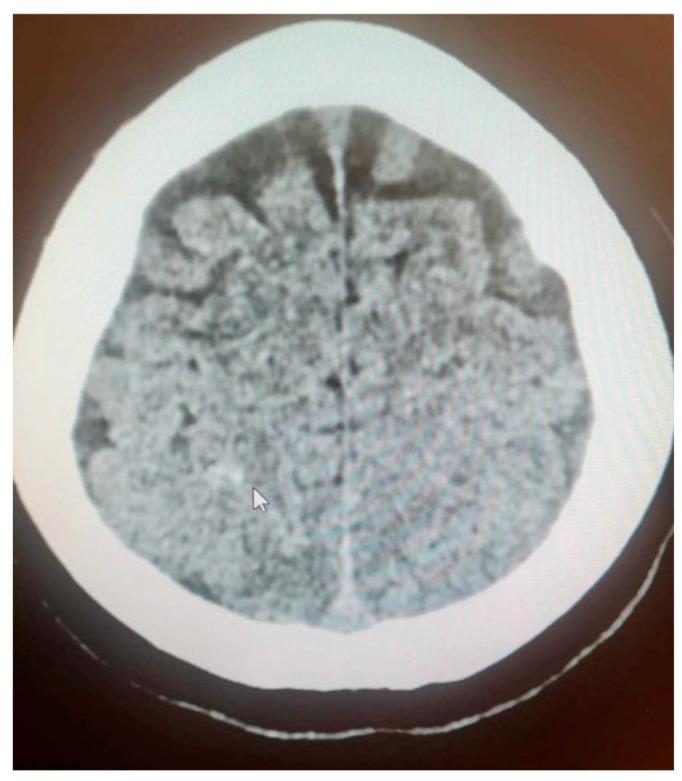 https://cdn.ncbi.nlm.nih.gov/pmc/blobs/baa7/11856242/a8498a07acf4/jcm-14-01361-g002.jpg