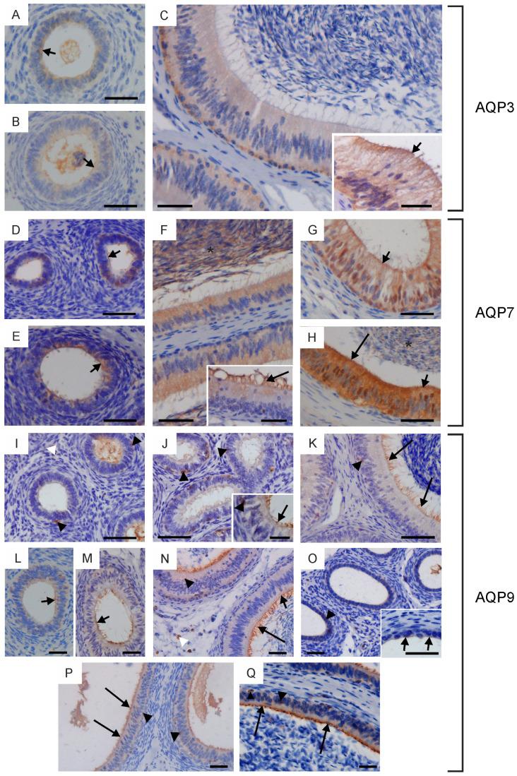https://cdn.ncbi.nlm.nih.gov/pmc/blobs/baa8/10855163/2d58233343e8/ijms-25-01567-g005.jpg