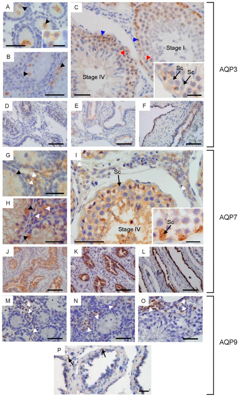 https://cdn.ncbi.nlm.nih.gov/pmc/blobs/baa8/10855163/a69cac0da4d0/ijms-25-01567-g004.jpg