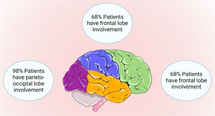 https://cdn.ncbi.nlm.nih.gov/pmc/blobs/baa9/10762327/088acaf7cb68/CCR3-12-e8393-g001.jpg
