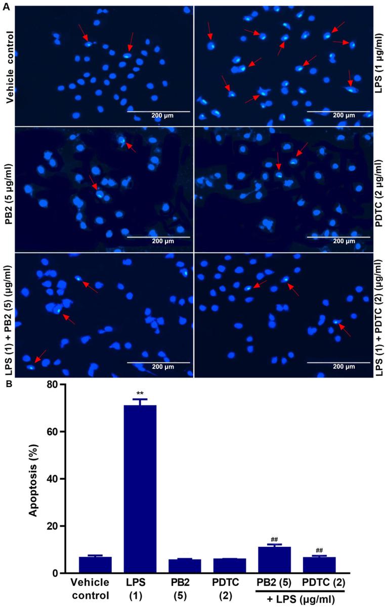 https://cdn.ncbi.nlm.nih.gov/pmc/blobs/baa9/7893691/38a584170521/mmr-23-04-11906-g01.jpg