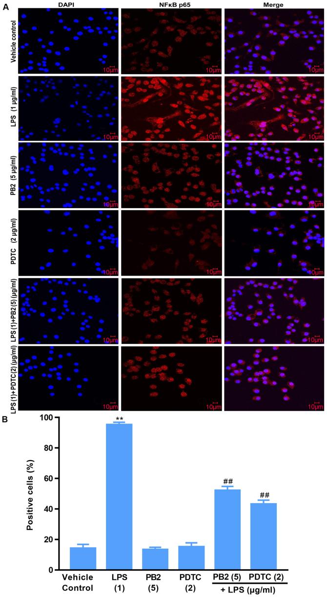 https://cdn.ncbi.nlm.nih.gov/pmc/blobs/baa9/7893691/b5082fe58b71/mmr-23-04-11906-g07.jpg