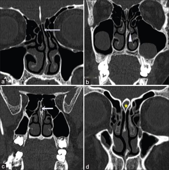 https://cdn.ncbi.nlm.nih.gov/pmc/blobs/baad/7944018/479a35254feb/AMS-10-422-g008.jpg