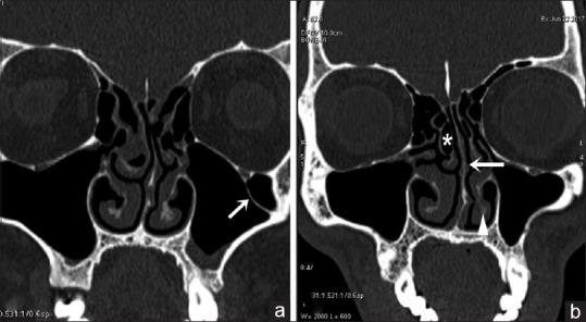 https://cdn.ncbi.nlm.nih.gov/pmc/blobs/baad/7944018/4dff626d7cbd/AMS-10-422-g005.jpg