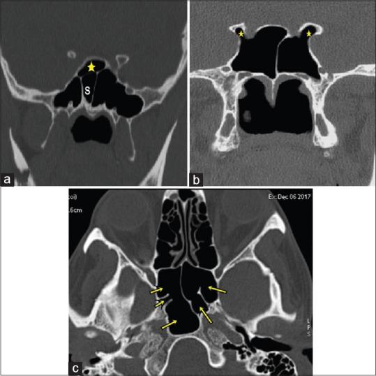 https://cdn.ncbi.nlm.nih.gov/pmc/blobs/baad/7944018/5c7f8aac674f/AMS-10-422-g007.jpg