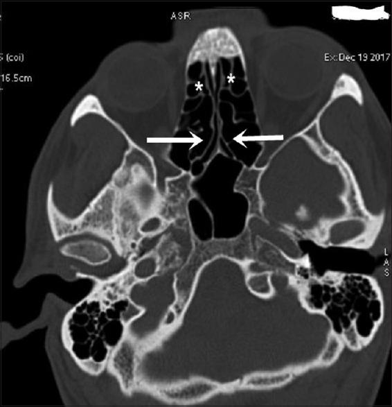 https://cdn.ncbi.nlm.nih.gov/pmc/blobs/baad/7944018/d18ad995f598/AMS-10-422-g002.jpg