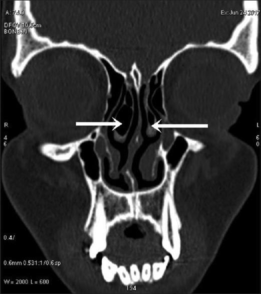 https://cdn.ncbi.nlm.nih.gov/pmc/blobs/baad/7944018/dcd92f97691f/AMS-10-422-g006.jpg