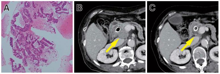 https://cdn.ncbi.nlm.nih.gov/pmc/blobs/baad/8307595/58bbb535e78f/diagnostics-11-01195-g002.jpg