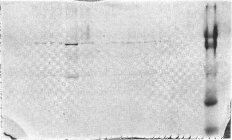 https://cdn.ncbi.nlm.nih.gov/pmc/blobs/bab6/1132326/2fa79319d8a9/biochemj00115-0013-a.jpg