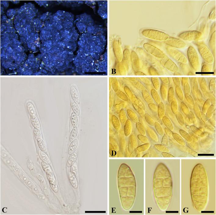 https://cdn.ncbi.nlm.nih.gov/pmc/blobs/bab9/8595605/7948e1d50121/fmicb-12-737541-g011.jpg