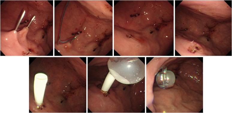 https://cdn.ncbi.nlm.nih.gov/pmc/blobs/baba/9833457/a76245b9126d/bn-15-e2-g001.jpg
