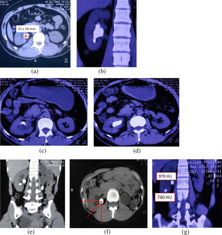 https://cdn.ncbi.nlm.nih.gov/pmc/blobs/bacf/5329720/850992e05ee8/gr2.jpg