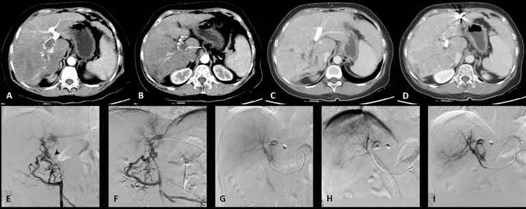 https://cdn.ncbi.nlm.nih.gov/pmc/blobs/bacf/9434401/44379af810d6/fonc-12-973357-g002.jpg