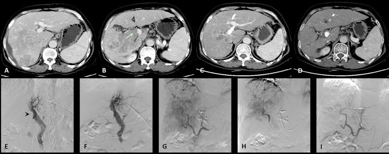 https://cdn.ncbi.nlm.nih.gov/pmc/blobs/bacf/9434401/ab78faab1b9c/fonc-12-973357-g001.jpg