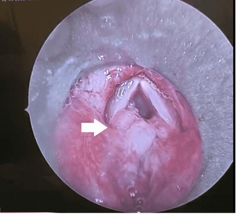https://cdn.ncbi.nlm.nih.gov/pmc/blobs/bad0/9381885/3509aec62695/cureus-0014-00000026959-i01.jpg
