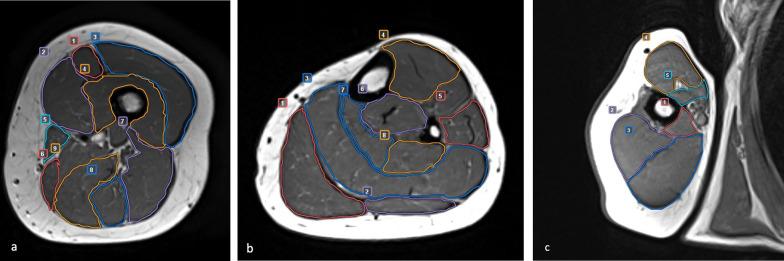 https://cdn.ncbi.nlm.nih.gov/pmc/blobs/bad0/9911574/2051ebaefcad/13244_2023_1374_Fig1_HTML.jpg