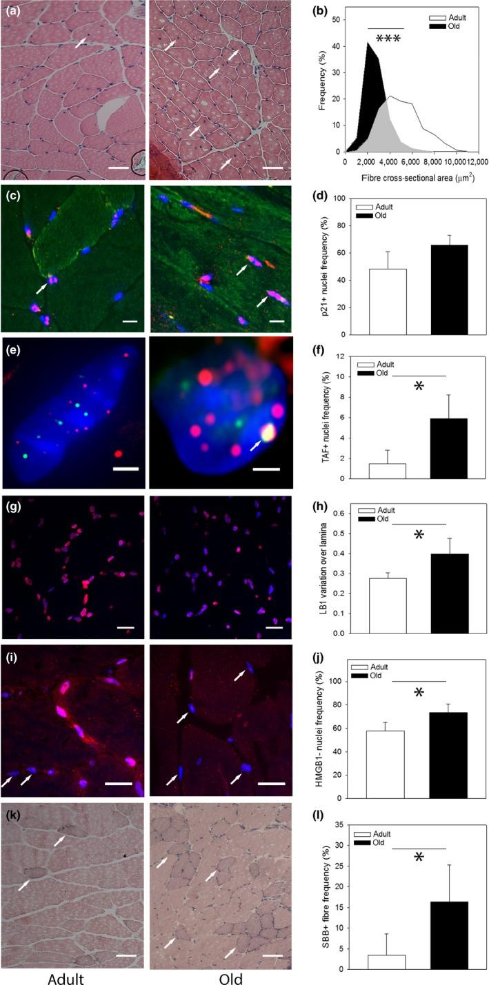 https://cdn.ncbi.nlm.nih.gov/pmc/blobs/bad1/6351849/609d4b5757e1/ACEL-18-e12848-g001.jpg