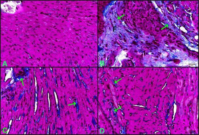 https://cdn.ncbi.nlm.nih.gov/pmc/blobs/bad2/11327467/1f50b62151fa/gr4.jpg
