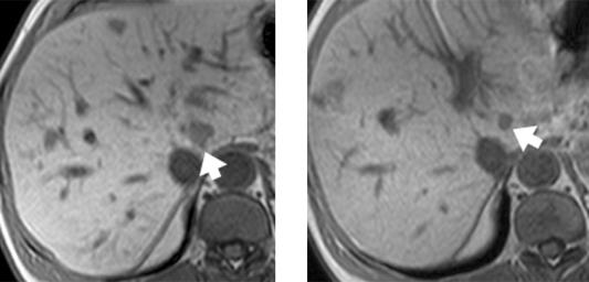https://cdn.ncbi.nlm.nih.gov/pmc/blobs/bad5/2582494/7786b129d5ab/ci08901403.jpg