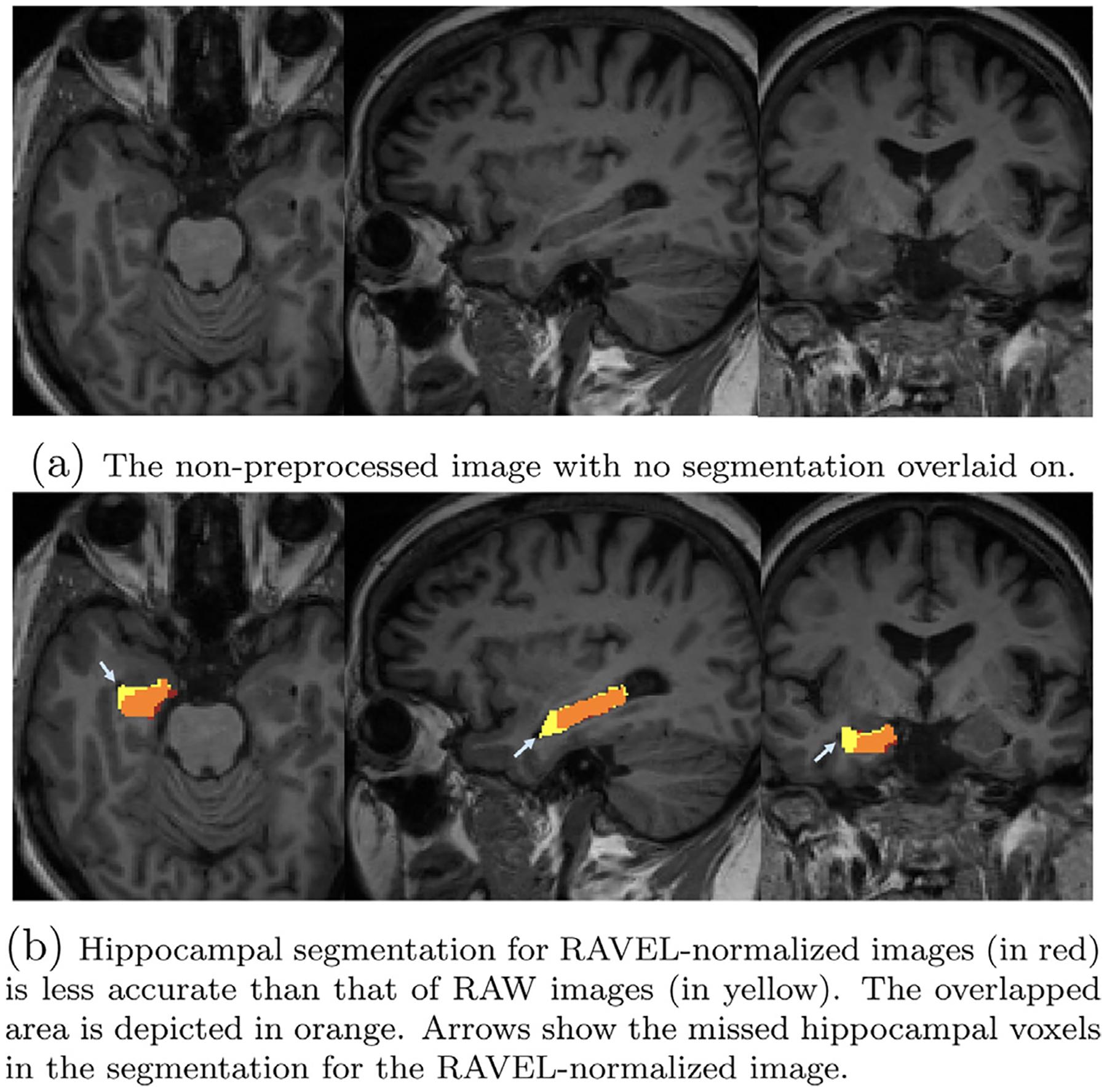 https://cdn.ncbi.nlm.nih.gov/pmc/blobs/badb/8820090/4bbef22da391/nihms-1770946-f0006.jpg