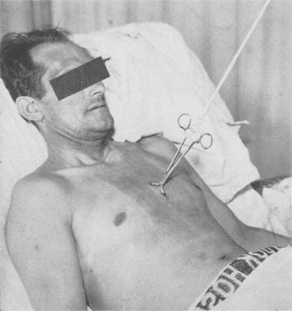 https://cdn.ncbi.nlm.nih.gov/pmc/blobs/bae7/3150827/fb8bfc0d556f/68_2010_46_Fig7_HTML.jpg