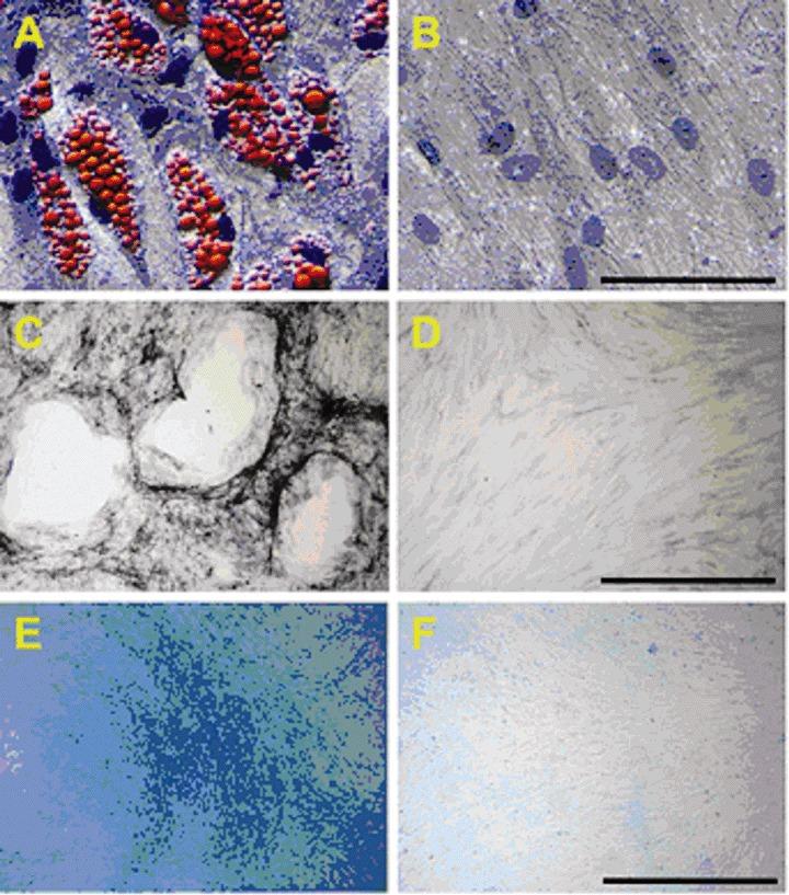 https://cdn.ncbi.nlm.nih.gov/pmc/blobs/baeb/3922358/d3e9a2692813/jcmm0011-0521-f2.jpg