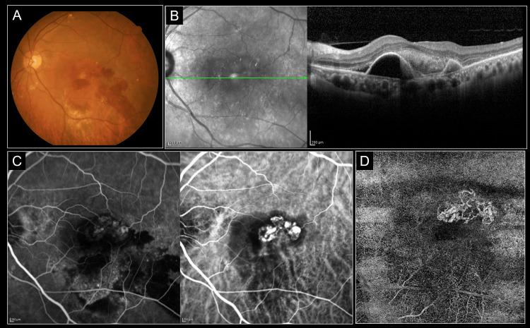 https://cdn.ncbi.nlm.nih.gov/pmc/blobs/baf0/11145932/83331b16ac8a/cureus-0016-00000059481-i01.jpg
