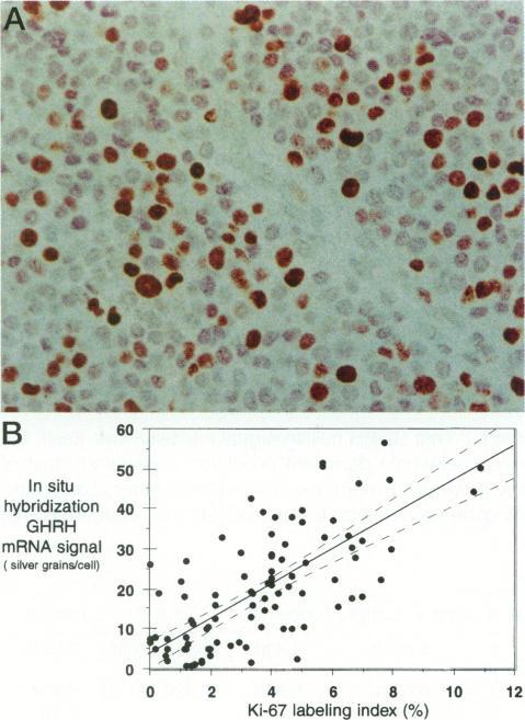 https://cdn.ncbi.nlm.nih.gov/pmc/blobs/baf3/1857857/0c145e45c66f/amjpathol00021-0135-a.jpg