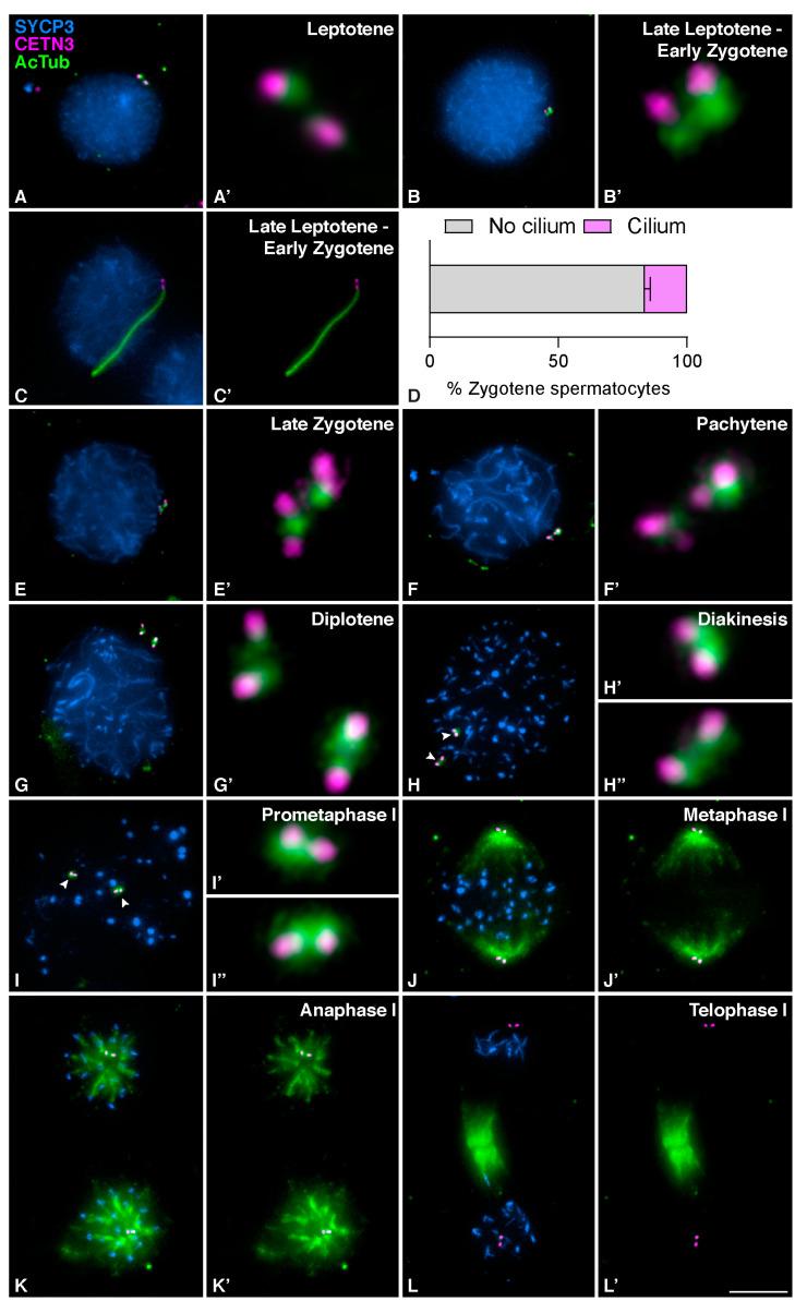 https://cdn.ncbi.nlm.nih.gov/pmc/blobs/bb03/9818220/e347629018ac/cells-12-00142-g001.jpg