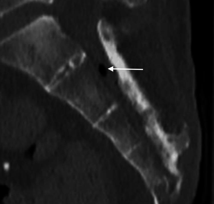 https://cdn.ncbi.nlm.nih.gov/pmc/blobs/bb04/11416873/74b057dd658d/cureus-0016-00000067628-i02.jpg