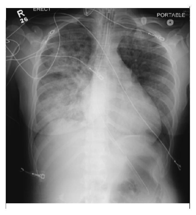 https://cdn.ncbi.nlm.nih.gov/pmc/blobs/bb10/5816884/ad5c179ae127/CRIE2018-4190629.001.jpg
