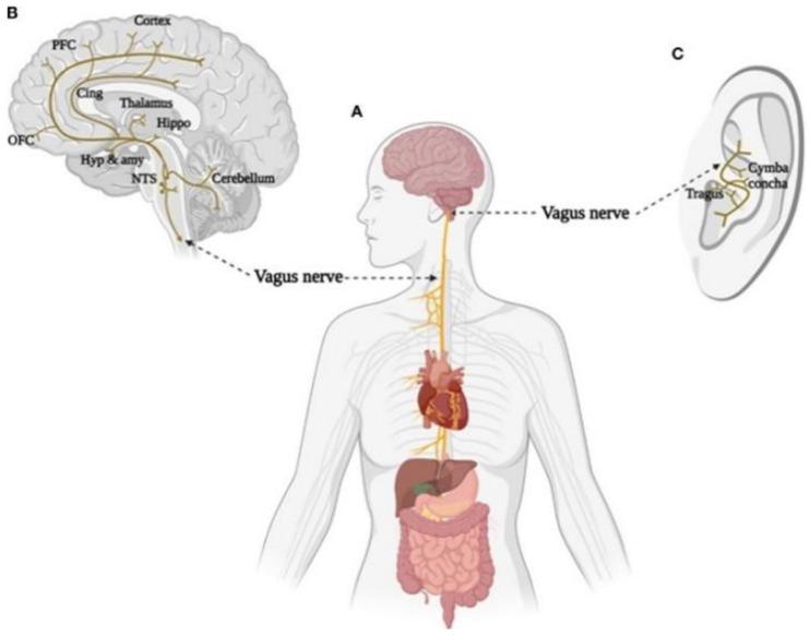 https://cdn.ncbi.nlm.nih.gov/pmc/blobs/bb12/10886536/a122a03c8c5f/biomedicines-12-00407-g004.jpg